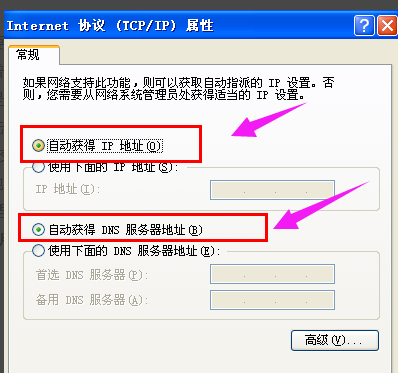 本地連接